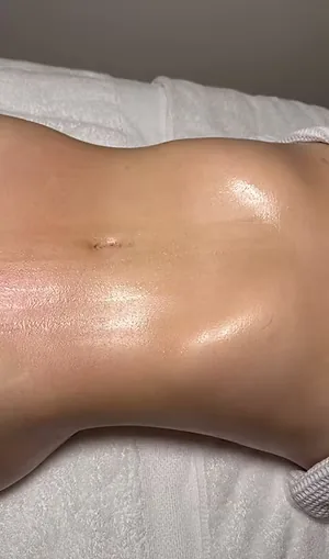 Abdomen, manual body sculpting (LinfoModellante®), after